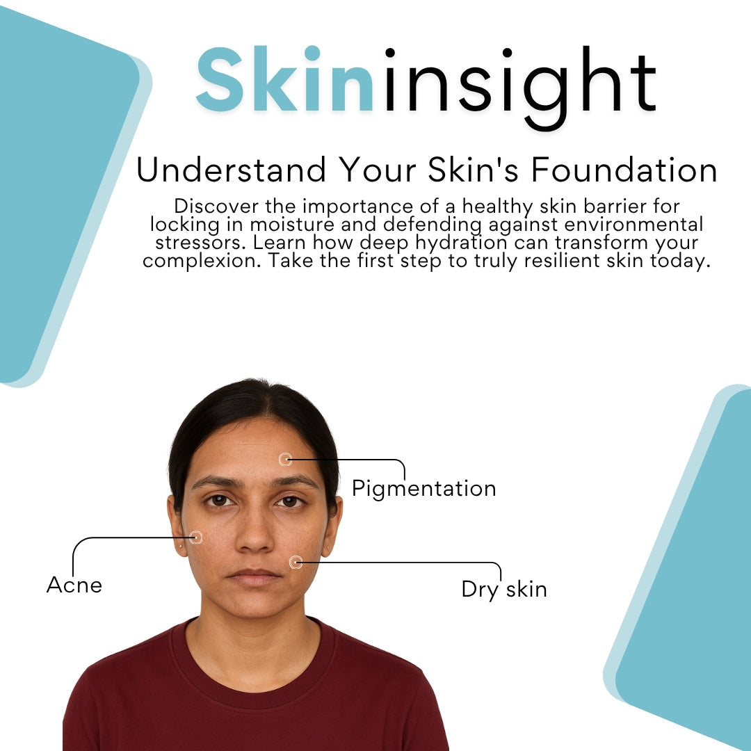 Breakout to Breakthrough: Winning the War Against Acne