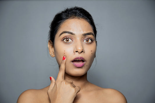 The Ultimate Skincare Guide for Women: From Tanning to Acne-Free Skin