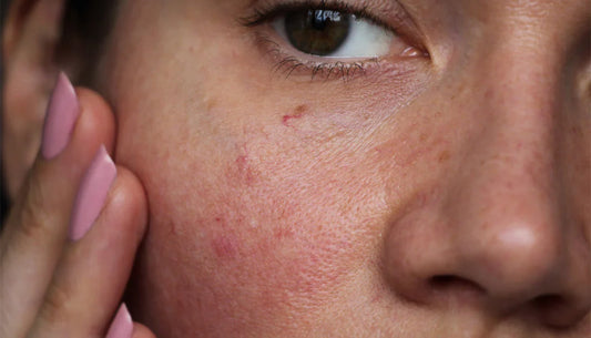 SPF 50 Uncovered: The Science Behind Broad-Spectrum Sun Protection and Daily Wear