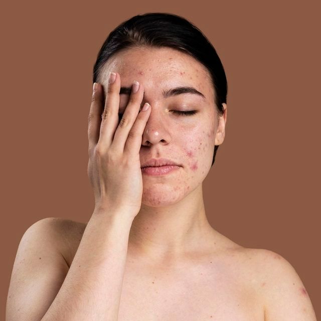 CoQ10 and Fine Lines: Why This Antioxidant is Your Anti-Aging Best Friend