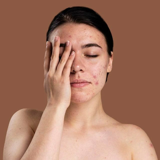 CoQ10 and Fine Lines: Why This Antioxidant is Your Anti-Aging Best Friend