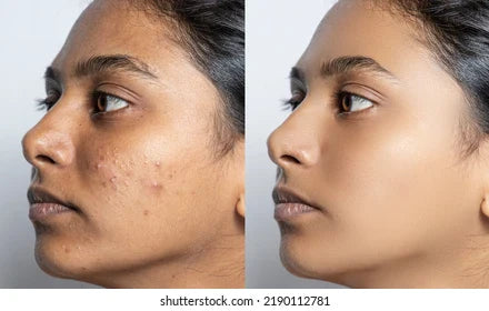 Clean Beauty, Indian Weather & Best Sellers: Why EOB Skincare Is Loved by Real People
