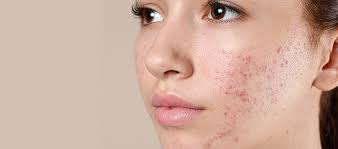 Hydration Hacks: Keep Your Skin Plump and Dewy All Year Round