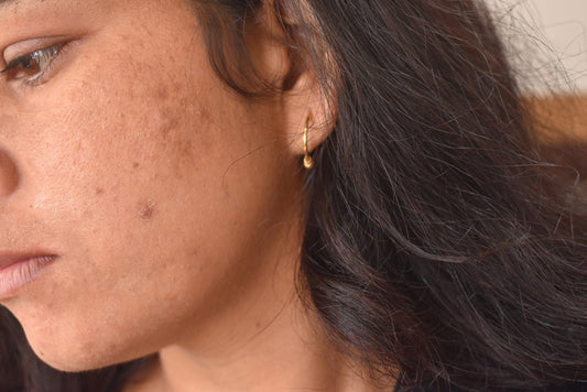 How Cold Weather Affects Women’s Skin and What You Should Do
