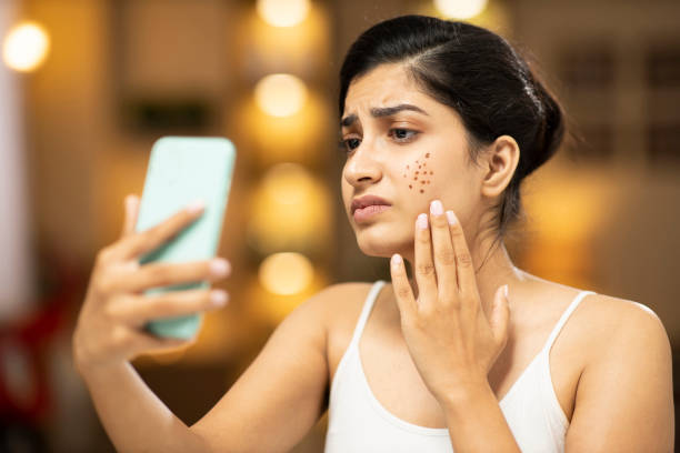Clogged Pores No More: A Beginner's Guide to Finding Non-Comedogenic Skincare