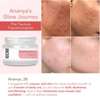 EOB Barrier repair Moisturizer