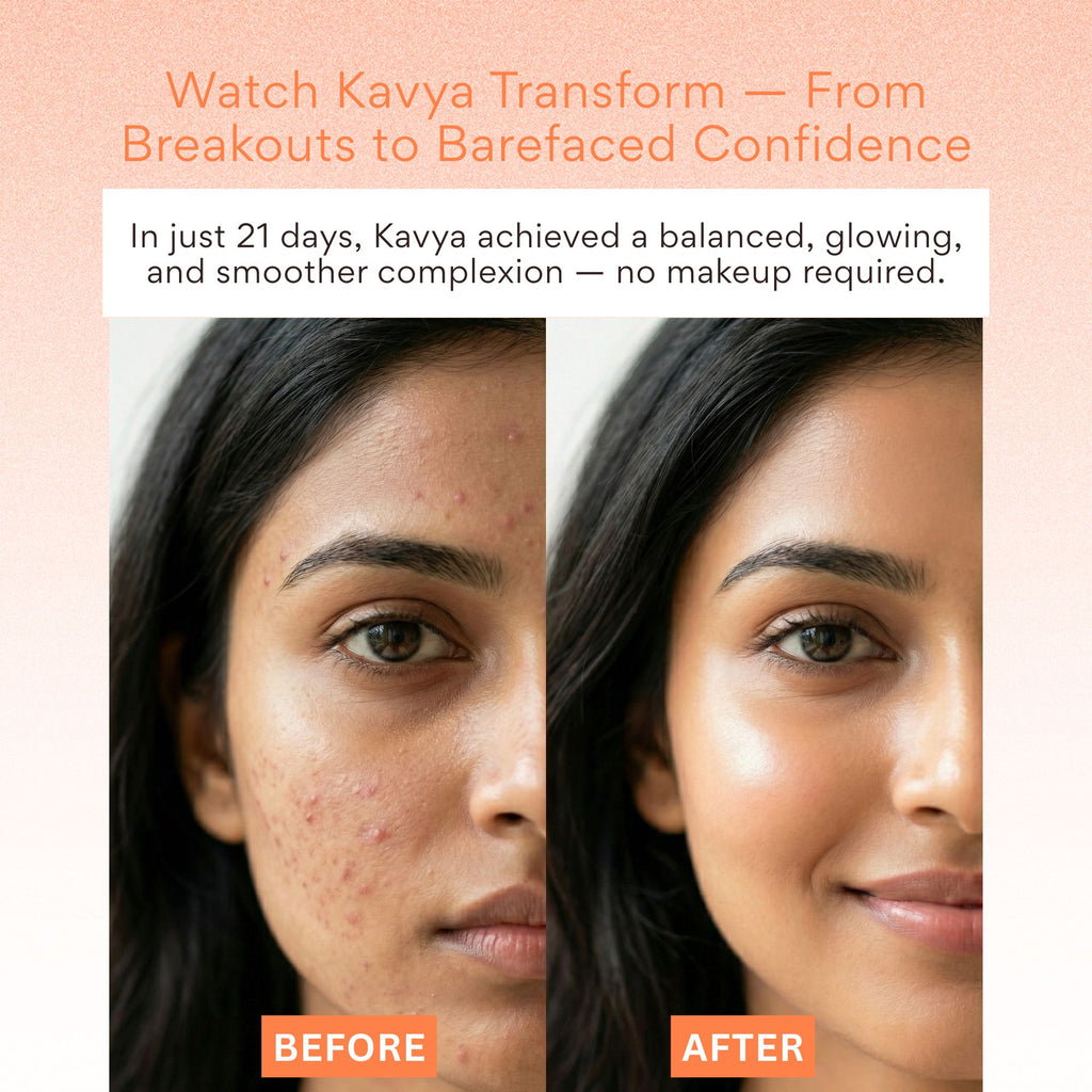 EOB Vitamin C Serum – Brightening, Collagen-Boosting