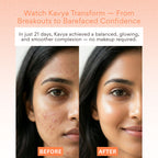 EOB Vitamin C Serum – Brightening, Collagen-Boosting