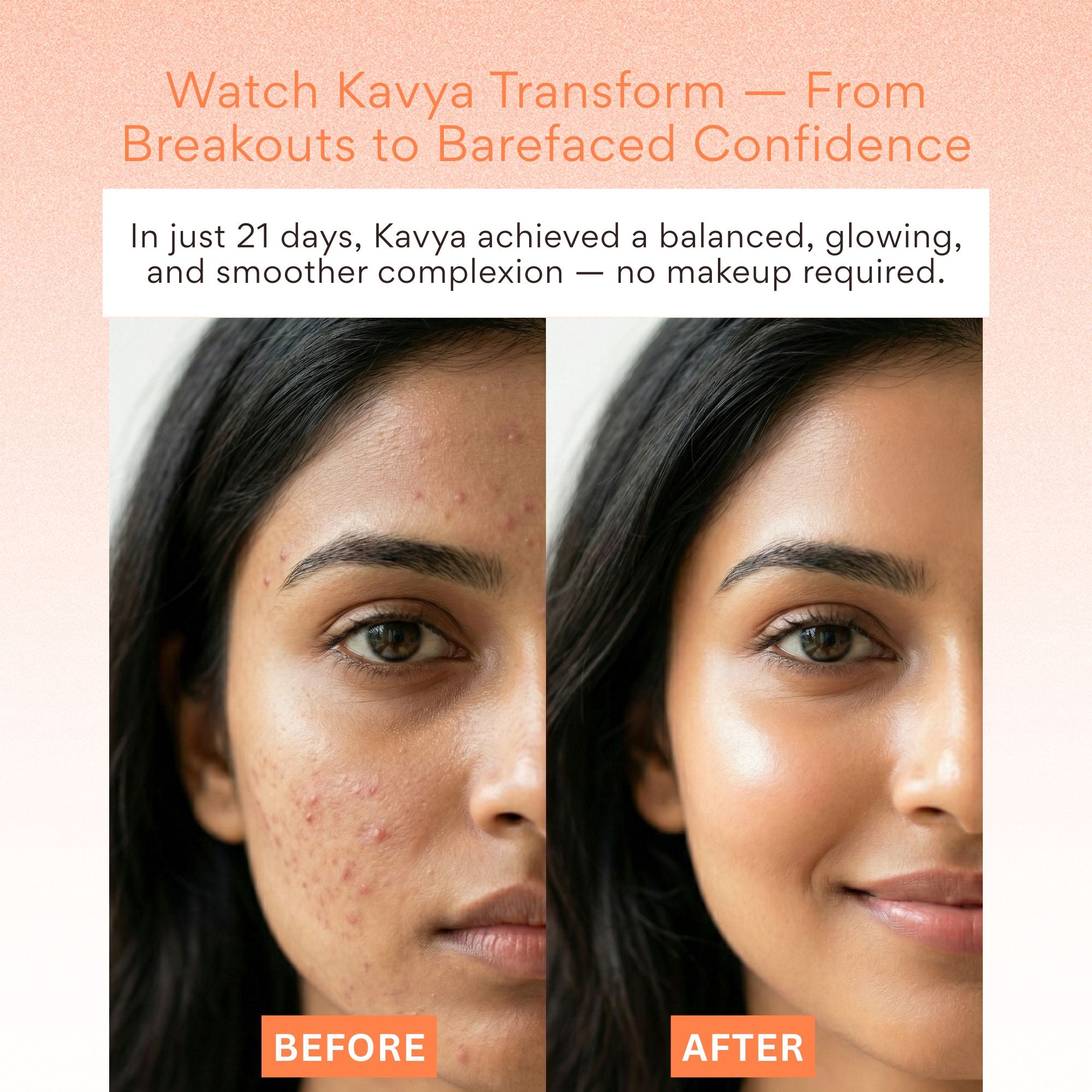 EOB Vitamin C Serum – Brightening, Collagen-Boosting