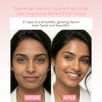 EOB CoQ10 Serum – Anti-Aging, Hydrating