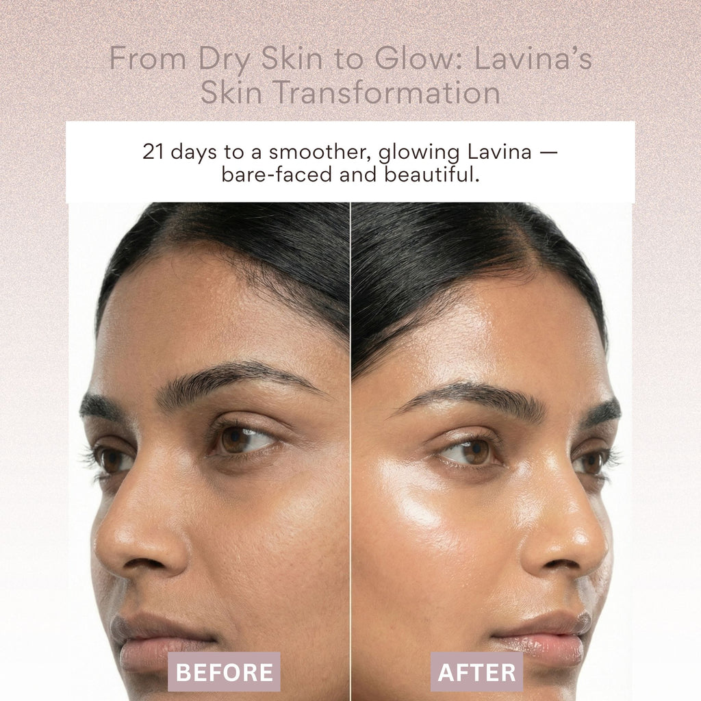 EOB Barrier repair Moisturizer