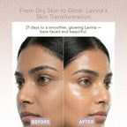 EOB Barrier repair Moisturizer