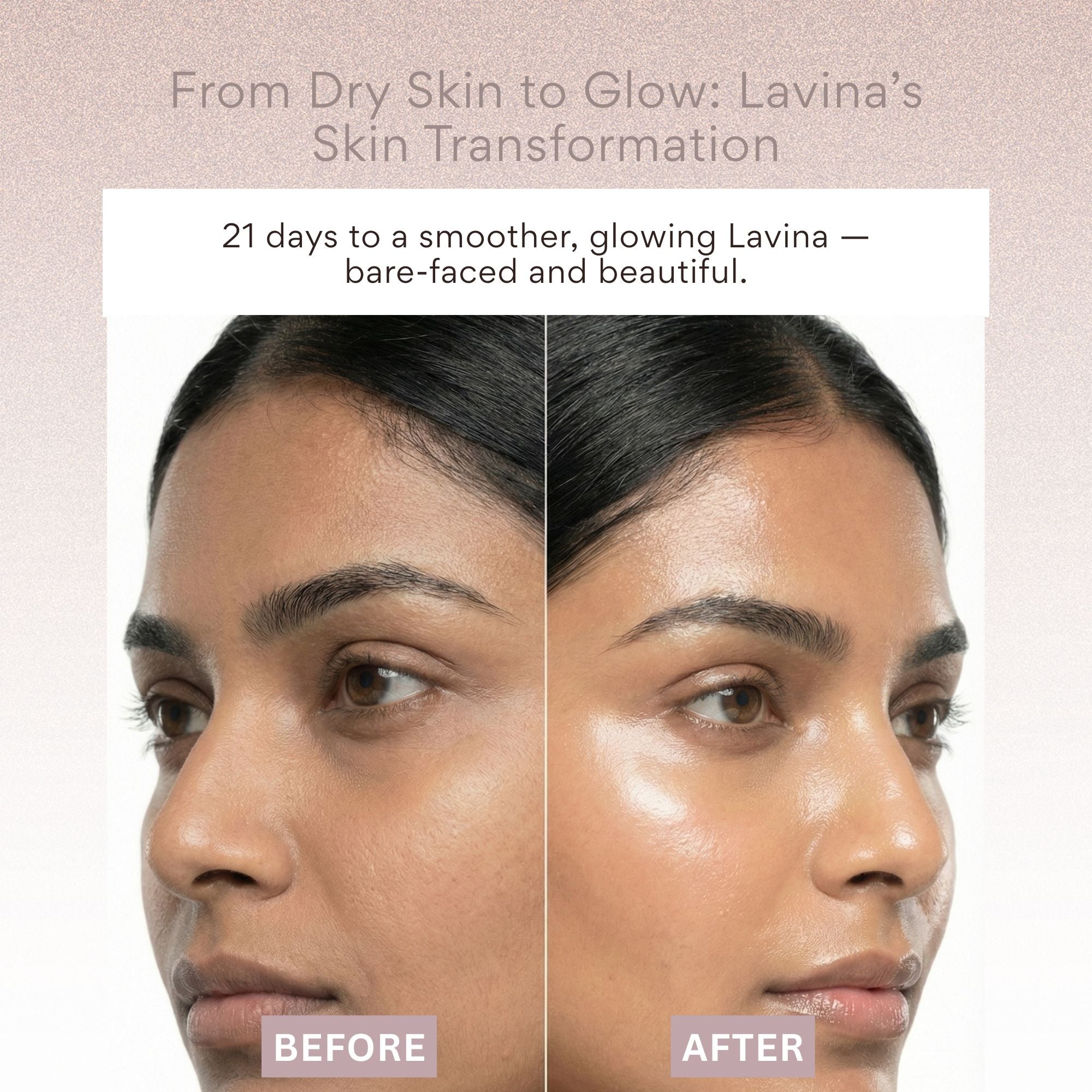 EOB Barrier repair Moisturizer